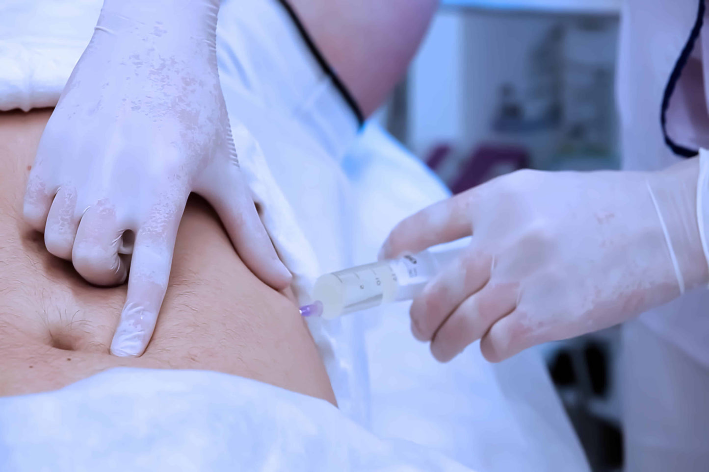 A medical professional in a white lab coat is inserting a syringe into a patient's abdomen for a fat grafting procedure.