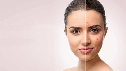 Scar Treatment Consult