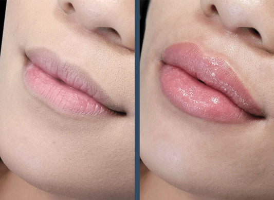Luscious Lips