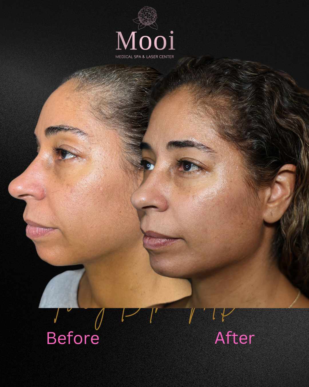 Biostimulators