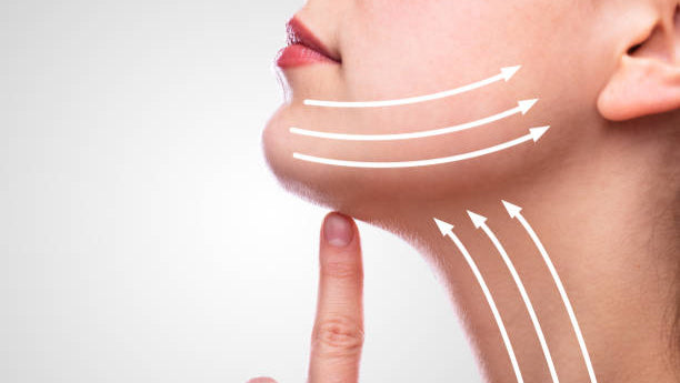 An illustration of non-surgical face and neck tightening, showing white lines indicating the direction of skin tightening on a person's face.