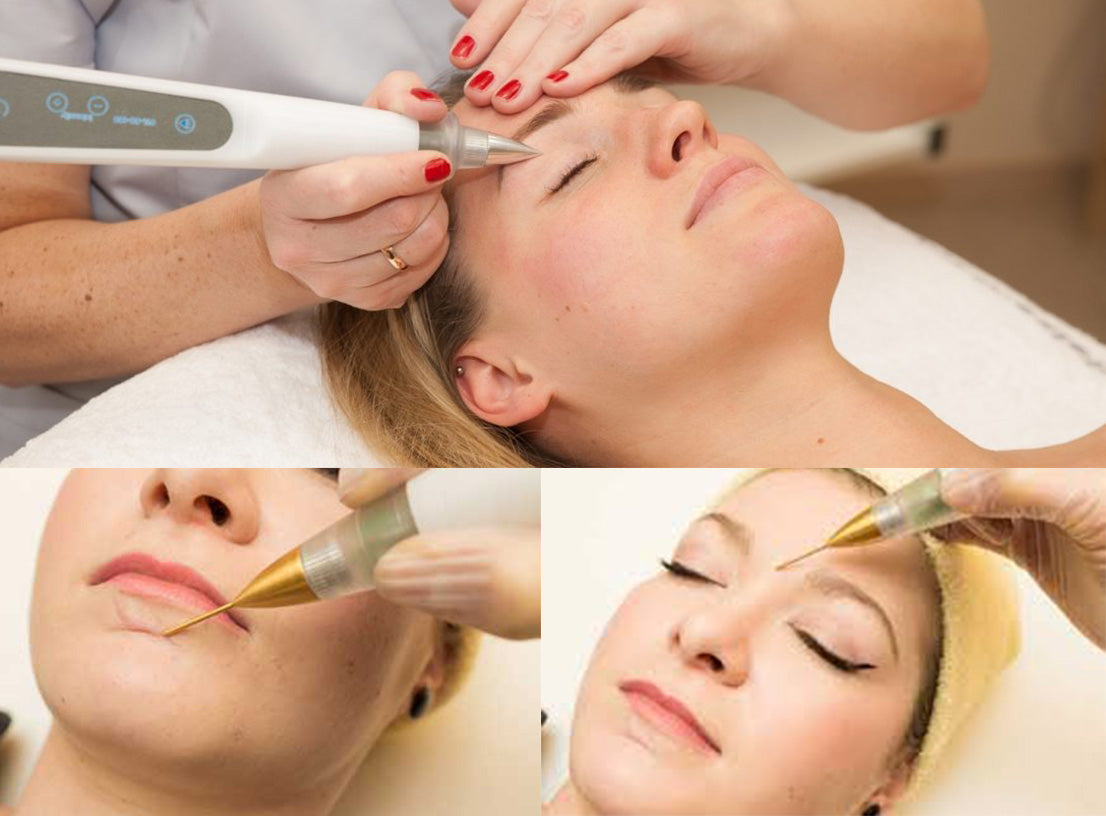 A series of images showing a plasma laser skin treatment process, with a technician applying a plasma-rich facial mask on a client who is lying down.
